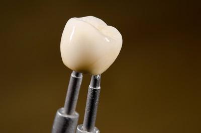 Dental tool holding up tooth crown in Rockville, MD