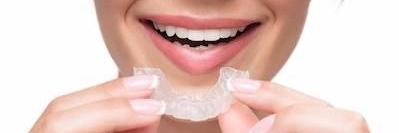 Patient putting on Invisalign at dentist in Rockville
