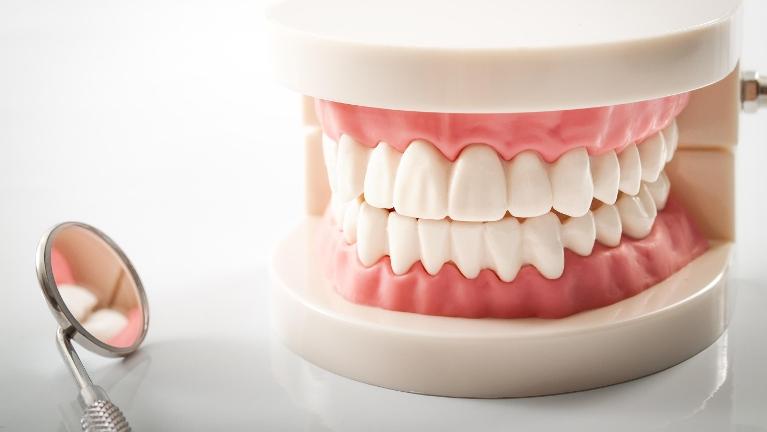 Model of teeth at emergency dentist in Rockville MD