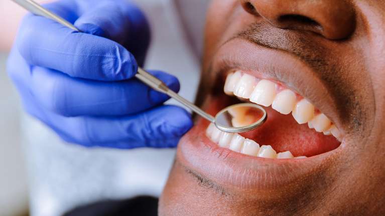 Close up of patient getting examined at dentist in Rockville, MD