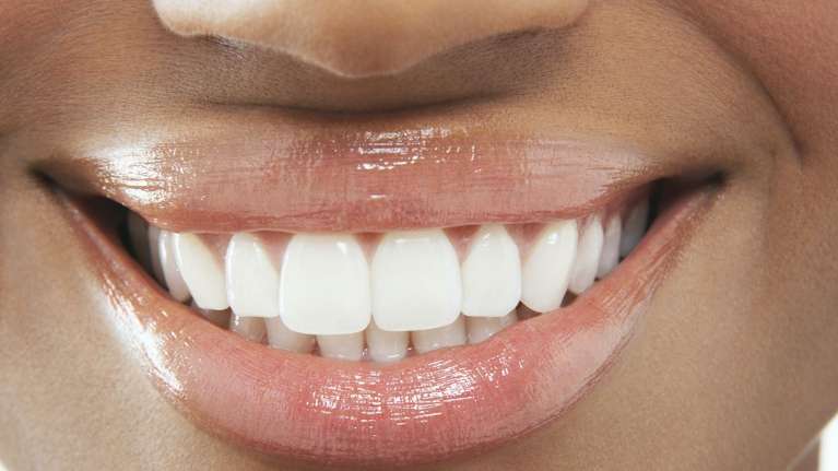 dental implants rockville