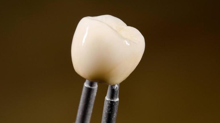 dental crowns rockville | broken tooth repair