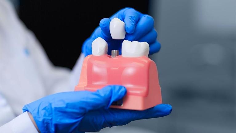 Dentist in Rockville holding model of dental implant & crown