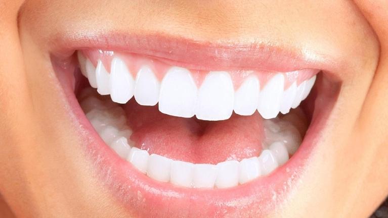 Close up of patient's smile after teeth whitening in Rockville, MD