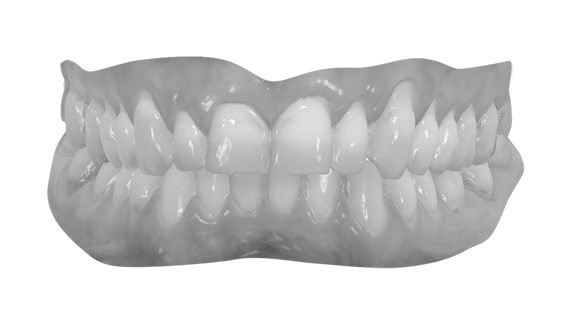 3Shape TRIOS Intraoral Scanner | Rockville, MD | Gladnick Family & Cosmetic Dentistry